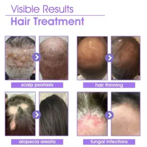 DEEVOO® ✨👩‍🔬 Hair Root Repair Growth Drops – Achieve Thicker Hair Fast⚡