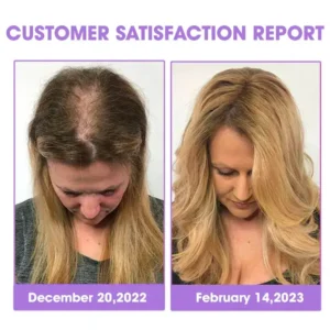 DEEVOO® ✨👩‍🔬 Hair Root Repair Growth Drops – Achieve Thicker Hair Fast⚡