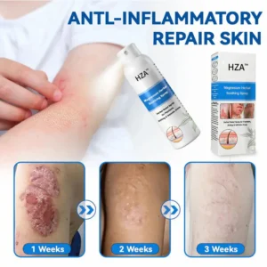 ✅ Official Store: HZA™ Magnesium Herbal Psoriasis Spray ⚕️ FDA Certified